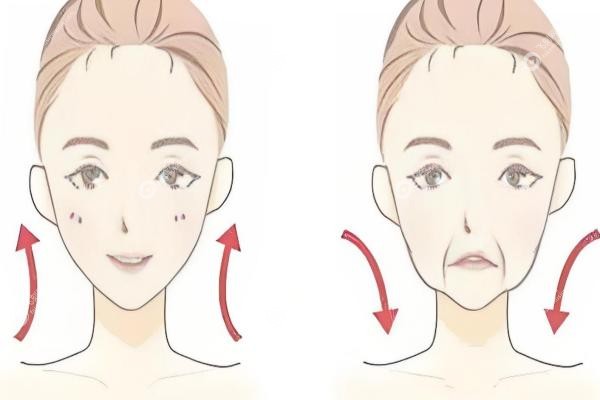 真实体验｜42岁二胎妈亲历：祝东升做的面部提<span style=