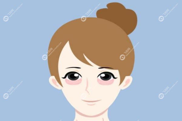 郑州王杨医生修复卧蚕效 果怎么样.jpg