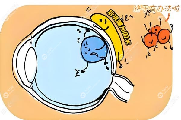 段安丽后巩膜加固术3000+例！材料正规/国内排名前三，案 例出诊医院全解！