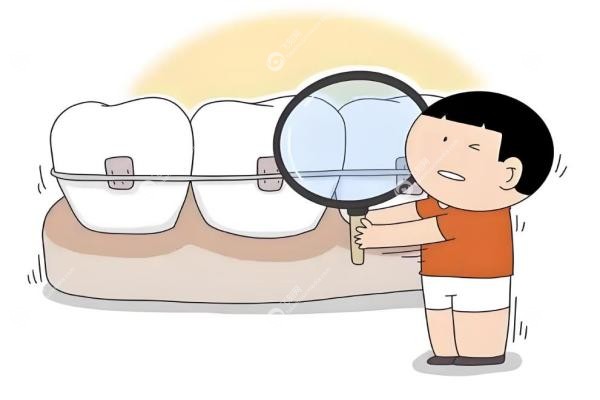 徐宝华正畸水平怎么样啊？儿童早矫+舌侧矫正口碑好,附私立坐诊攻略+收费清单！2