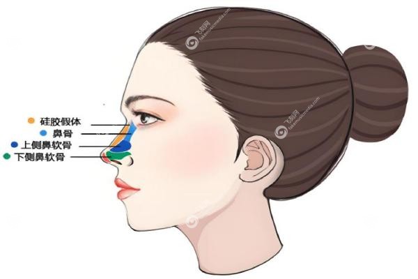 重庆艺星朱家旭隆鼻怎么样？20年0失败+妈生鼻技术，看完案 例我冲了！3