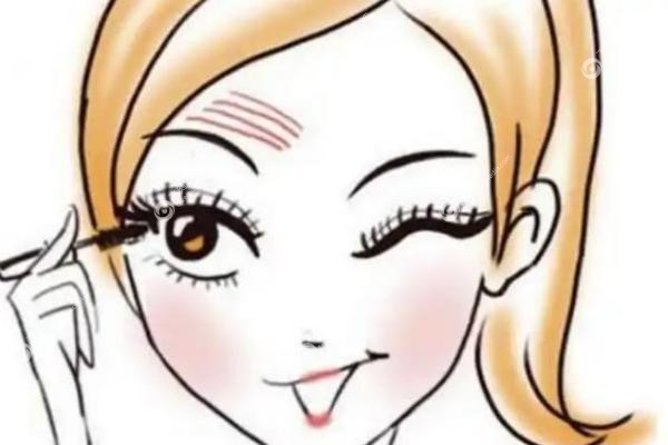 吕方中医生双眼皮手术案 例.jpg