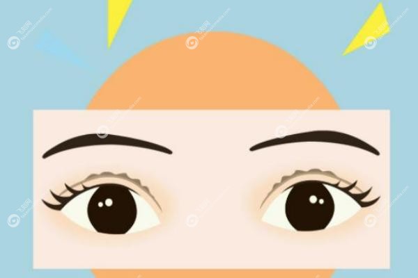 吕方中医生双眼皮手术案 例.jpg