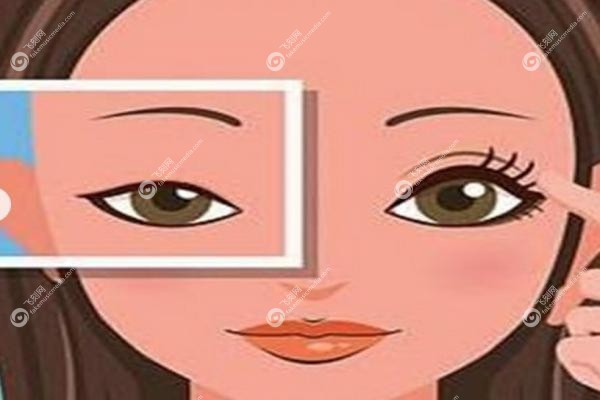 黄军伟双眼皮术后半年的<span style=