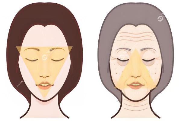 穆宝安面部提升技术如何？微创自然，V美减龄保持8年+,拉皮价格/效 果案 例揭秘！2