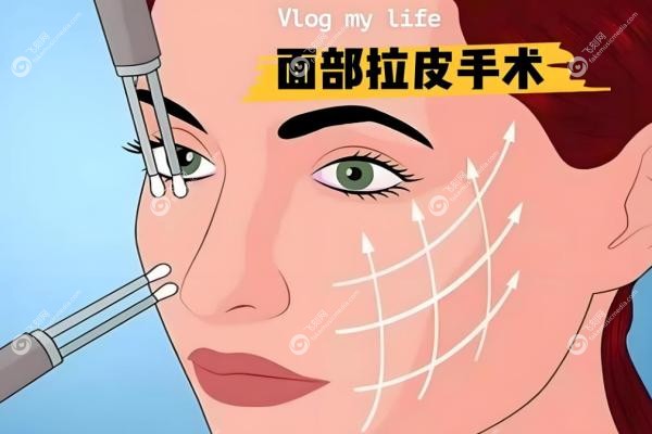 穆宝安面部提升技术如何？微创自然，V美减龄保持8年+,拉皮价格/效 果案 例揭秘！