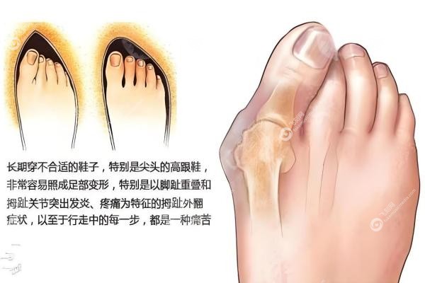 苏敬达和温建民谁厉 害？温建民中医微创VS苏敬达3mm隐形，谁适合你？