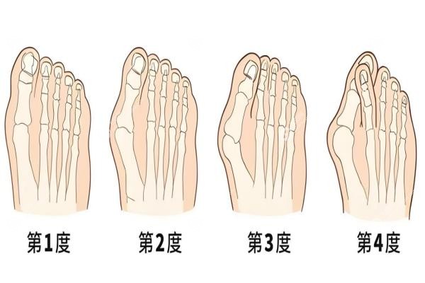 苏敬达和温建民谁厉 害？温建民中医微创VS苏敬达3mm隐形，谁适合你？3