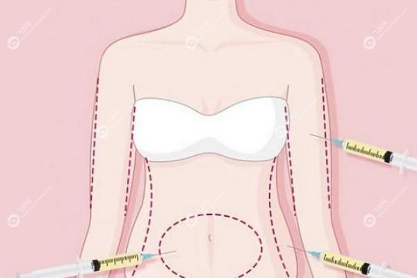 广州邓晟华医生野生<span style=