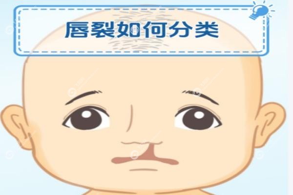 国内唇腭裂修复医院排名.jpg