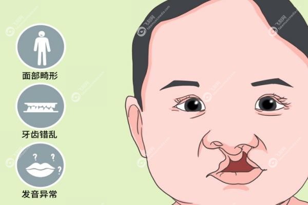 国内唇腭裂修复医院排名.jpg