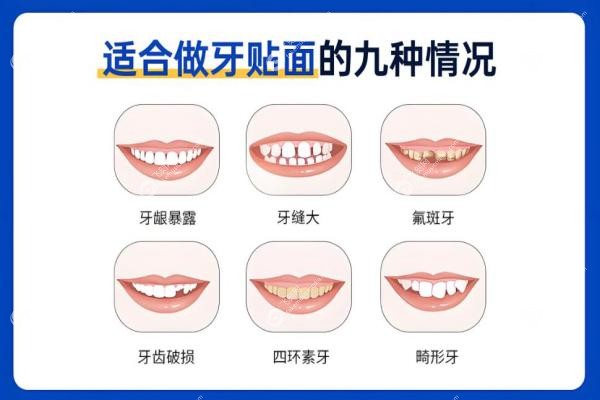 北京做牙贴面哪家好？劲松/中诺/海德堡等牙贴面医院排名前十 强！4