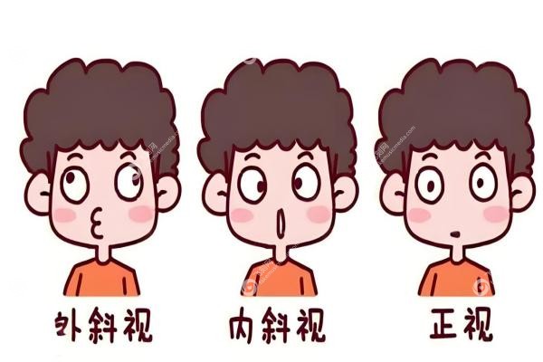 北京斜视手术医生排名前十：付晶/翟长斌等同仁