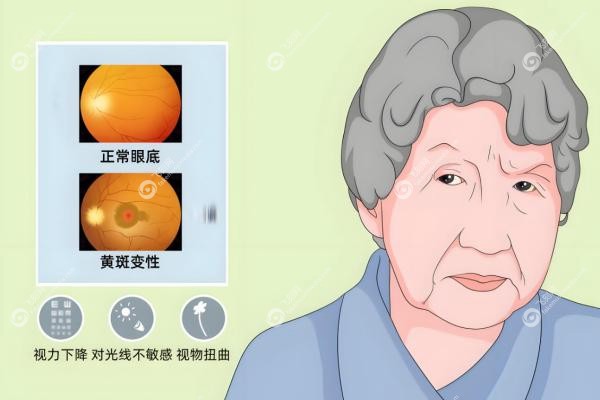 北京看眼底黄斑病变哪家医院好？同仁协和领 衔，私立茗视光等排名前十！