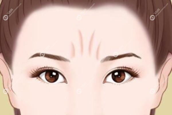 额头川字纹怎么消除.jpg