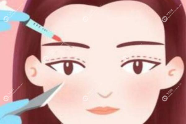 邹俊峰双眼皮效 果怎么样.jpg