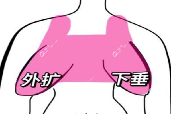 不开刀乳房上提手术多少钱.jpg