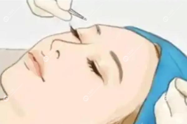 爱思特张姣姣修复技术怎么样.jpg