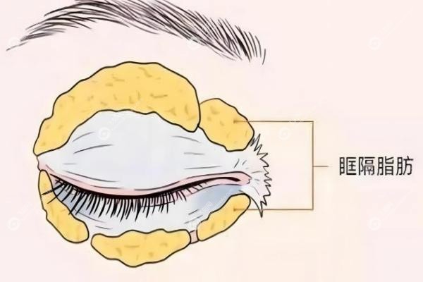 爱思特张姣姣修复技术怎么样.jpg
