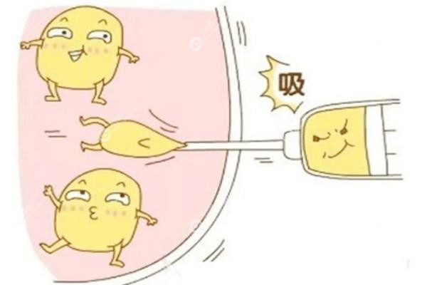 郑州抽脂医生.jpg
