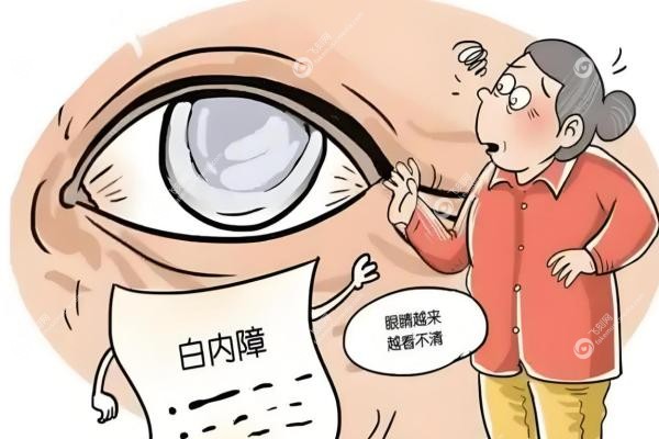 爱尔眼科白内障收费价目表:晶体1500元起,技术和免 费政 策全知道!3 爱尔眼科白内障收费价目表:晶体1500元起,技术和免 费政 策全知道!3