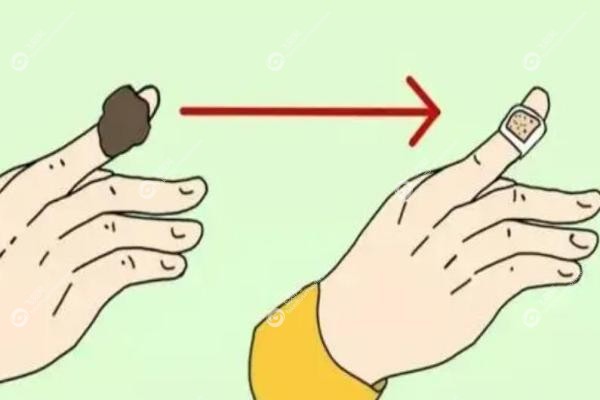 断指再造术大概多少钱.jpg 断指再造术大概多少钱.jpg