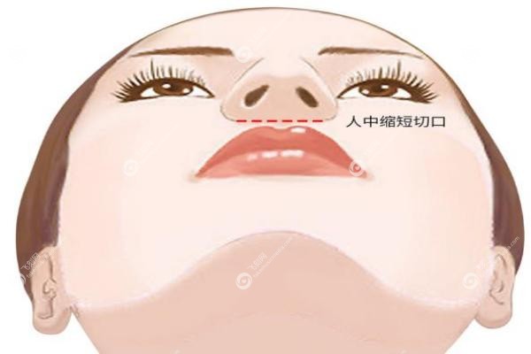 北京人中缩短选王晓健还是张曼好？王晓健自然vs张曼保守，技术风格全对比3