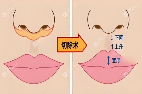 北京人中缩短选王晓健还是张曼好？王晓健自然vs张曼保守，技术风格全对比2