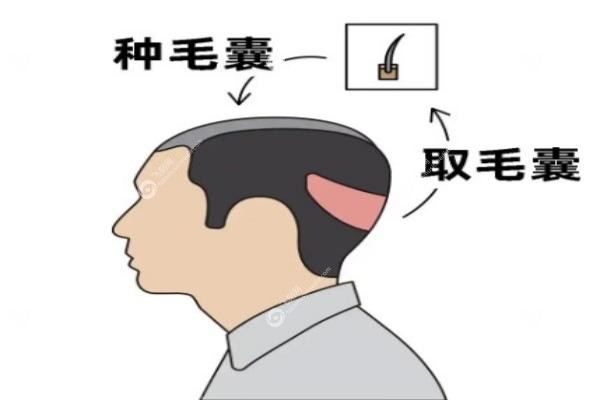 植发机构.jpg