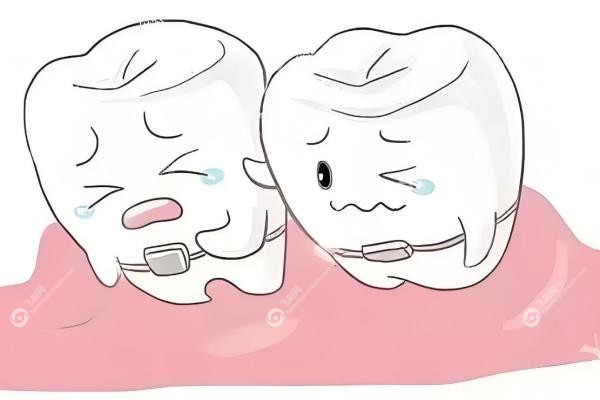 日本正畸品牌有哪些？拓美、绮丽来等知 名品牌全揭秘，帮你轻松选择！3