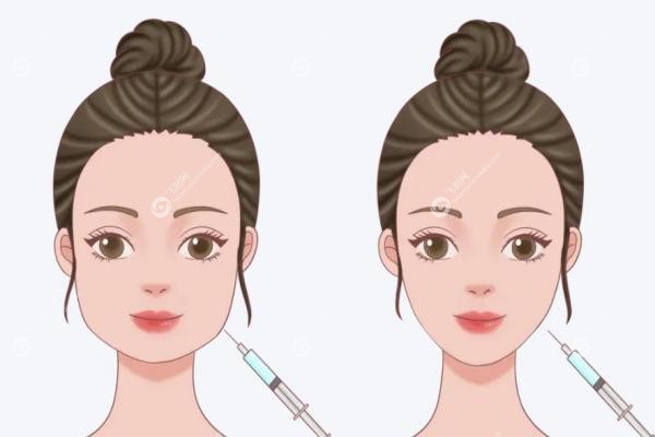 皮贴骨针是什么？真能解决馒化脸，价格6K起一支，效 果维持期揭秘！2