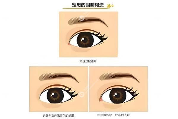 姬东硕双眼皮怎么样？ 初眼&修复都放心,高口碑技术强,附价格与预约攻略！2