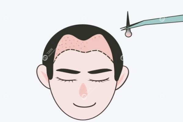 雍禾和碧莲盛哪家好.jpg