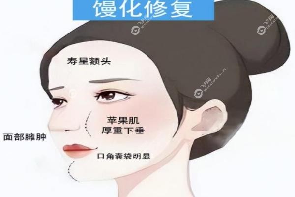 北京馒化修复口碑好的医生排名：马继光/王晓军/刘彦军/高超等医生排名前十！2