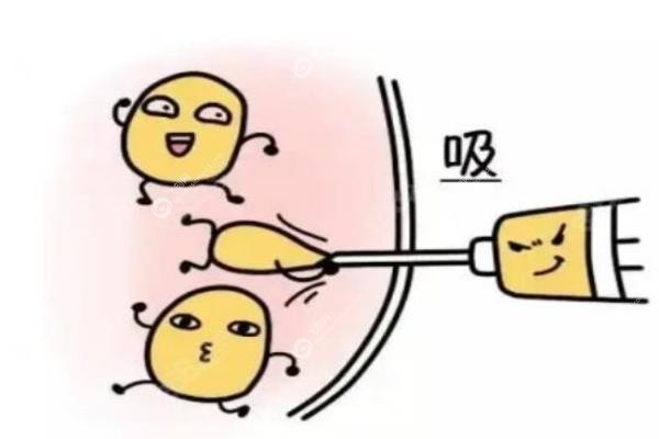 长沙吸脂.jpg