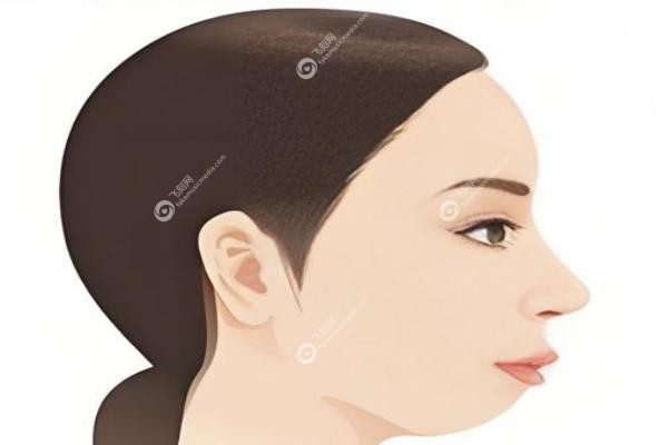 珠海下巴后缩矫正医院哪家好.jpg