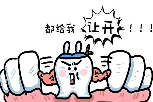 瑞士种植牙有几种品牌？ITI/百丹特等品牌排名前五，附选择指南！2