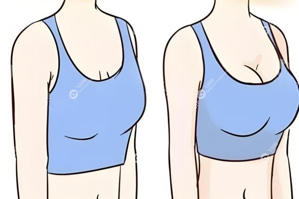 美国曼托胸假体有几种?魅力版/精 致版/至 尊版,哪种型号手感自然真香?2 美国曼托胸假体有几种?魅力版/精 致版/至 尊版,哪种型号手感自然真香?2