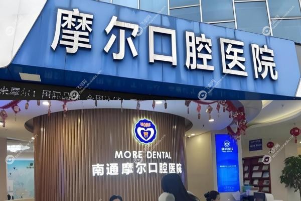 南通摩尔口腔医院价格表：洗牙58元/种植牙1.68k/牙齿矫正9.5k2