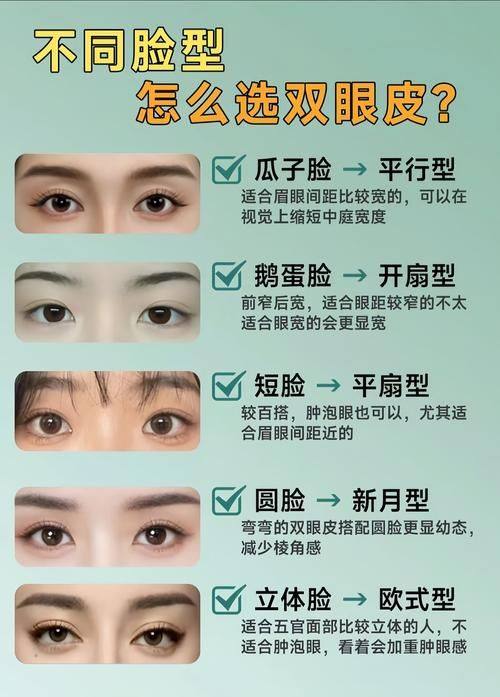 二、西安医学校陈杰双眼皮实例