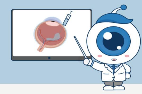 梦戴维角膜塑形镜有哪些系列