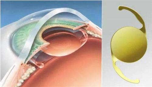 三、廊坊爱尔眼科医院地址在哪里