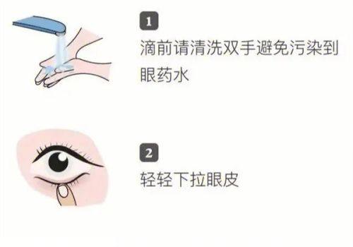 一、廊坊爱尔眼科医院是正规的吗?