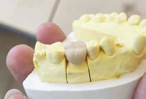 三、、去西安中诺口腔医院要注意啥?