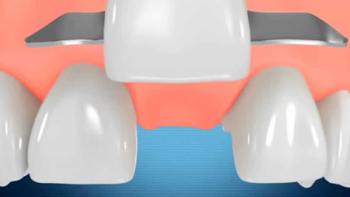 一、西安中诺口腔医院在西安市做牙齿整形好吗?