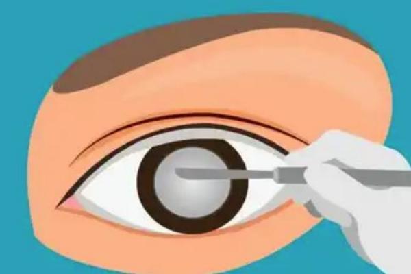 广州越秀区普瑞眼科医院