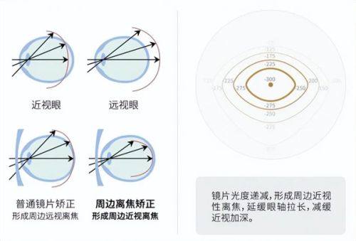 中山大学中山眼科中心哪个院区好？珠江新城疑难眼病/区庄初诊，教你挂号！