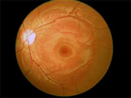 二、郑州普瑞眼科医院谢冰医生简介