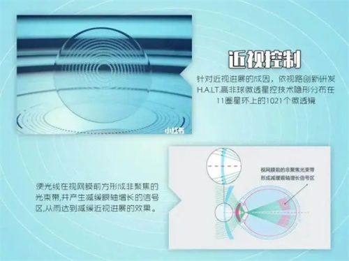 二、广州佰视佳眼科医院刘文群医生简介