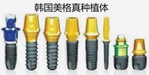 泉州美特尔口腔医院种植牙怎么样?技术靠谱价格合理,医生经验丰富超值得选！ 